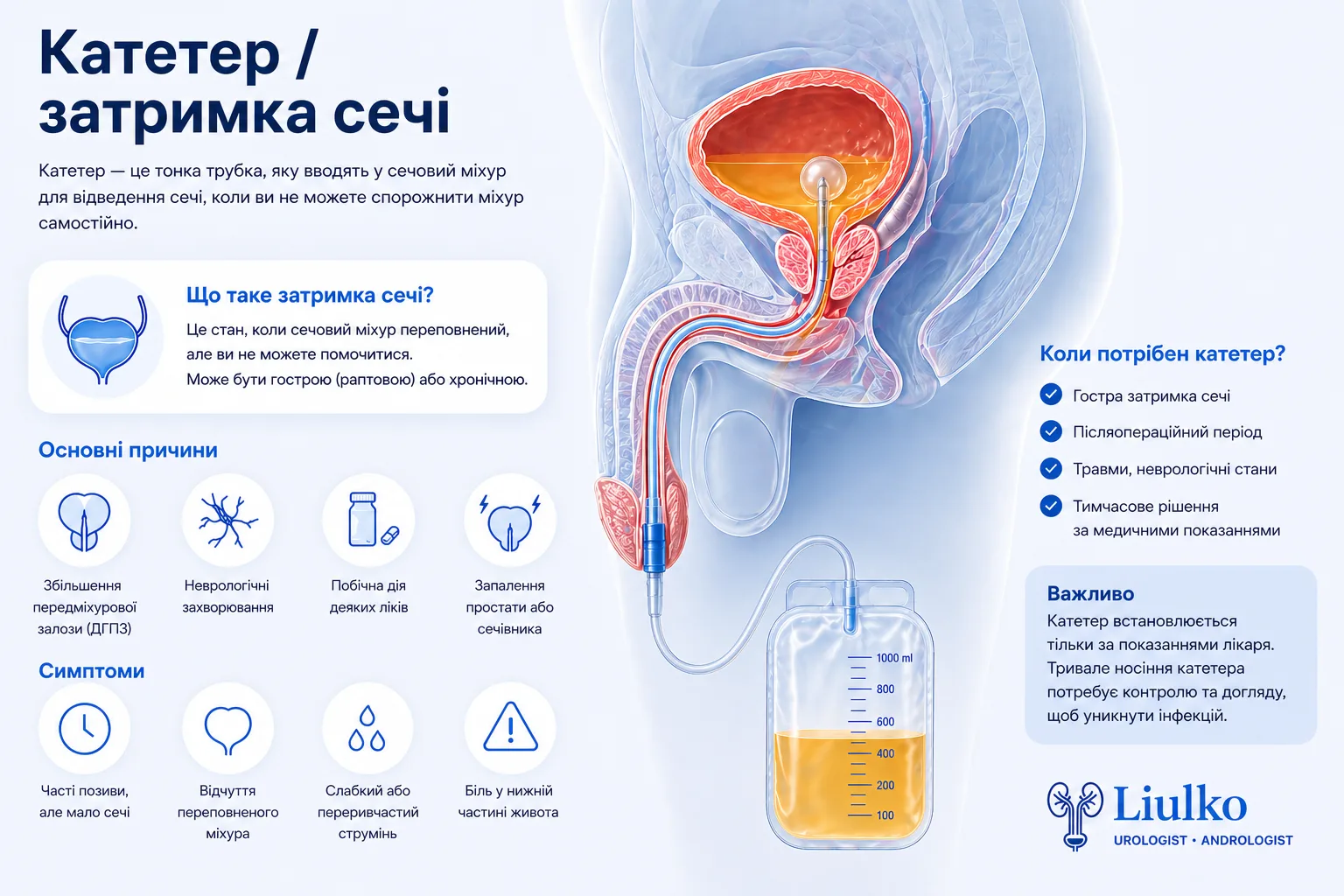 Катетер Фолея при гострій затримці сечі у чоловіка